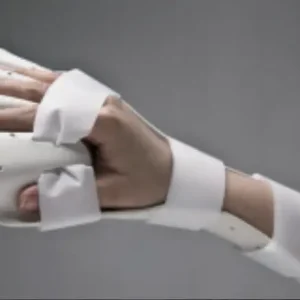 Preformed Anti-Spasticity Ball Splint
